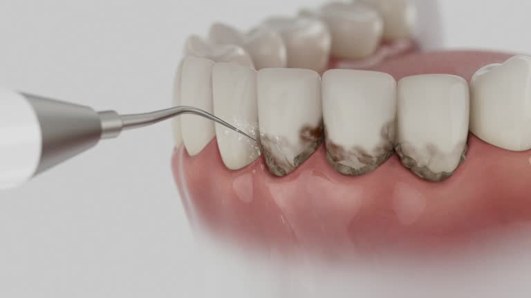 Trusted Teeth Cleaning And Checkup service in Olathe, CO - Dentist Open Now